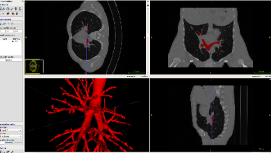 健培AI團(tuán)隊(duì)在全球EXACT’09賽事中取得優(yōu)異成績